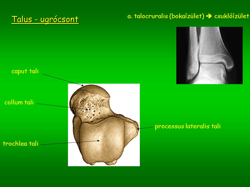 Az alsó végtag ortopédiai betegségei